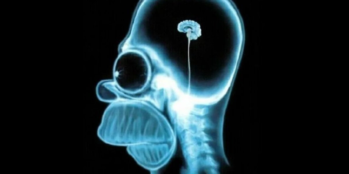 Тихий враг мозга: как лишний вес незаметно разрушает вашу память и интеллект Тихий враг мозга: как лишний вес незаметно разрушает вашу память и интеллект